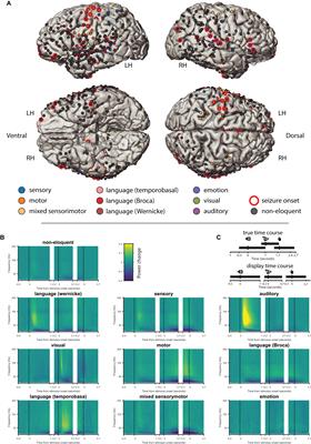 Combining Gamma With Alpha and Beta Power Modulation for Enhanced Cortical Mapping in Patients With Focal Epilepsy